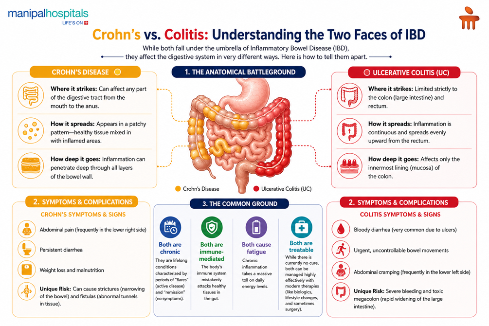 inflammatory bowel disease ibd treatment outcomes