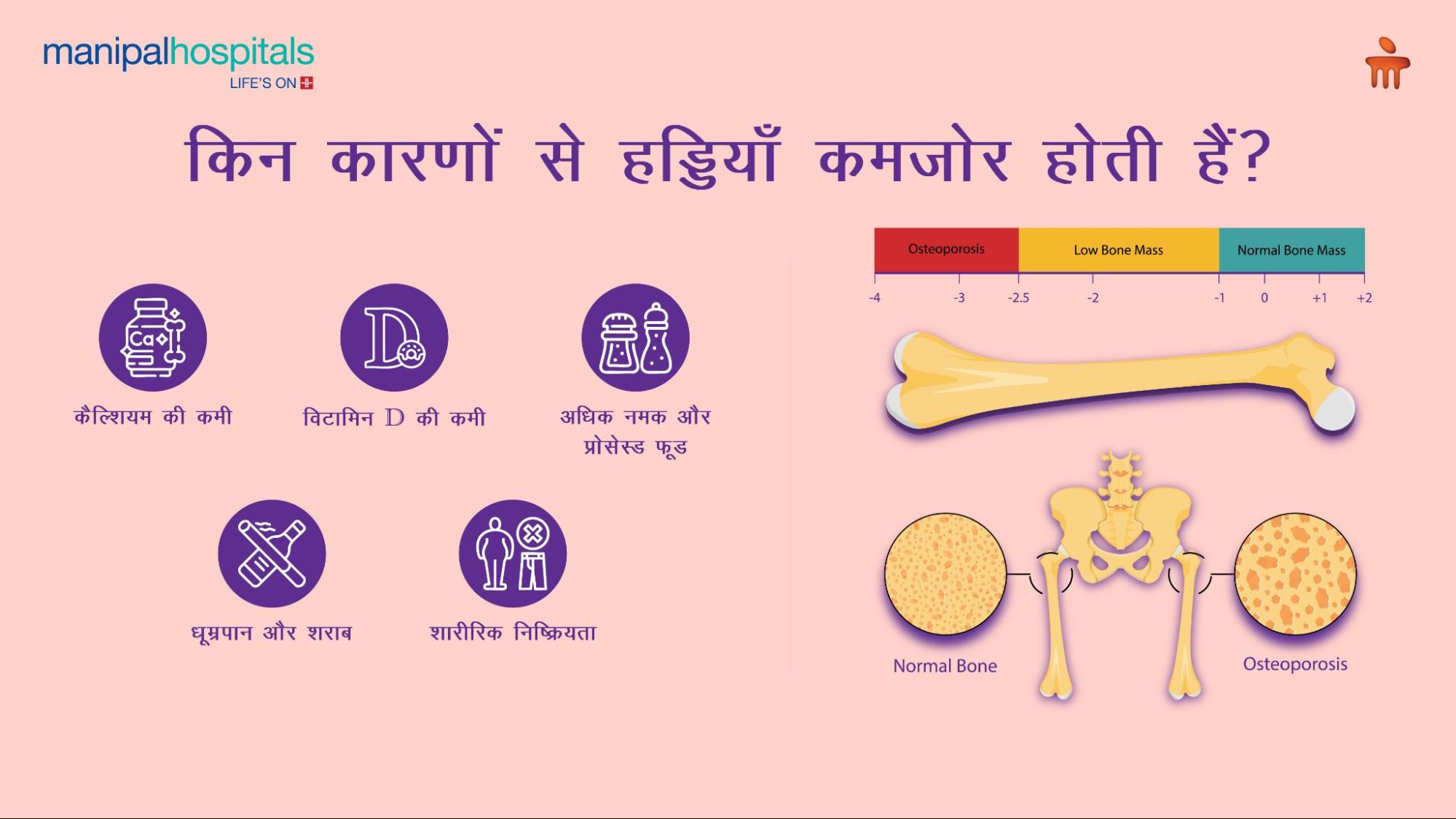 हड्डियों के स्वास्थ्य के लिए सर्वोत्तम खाद्य पदार्थ