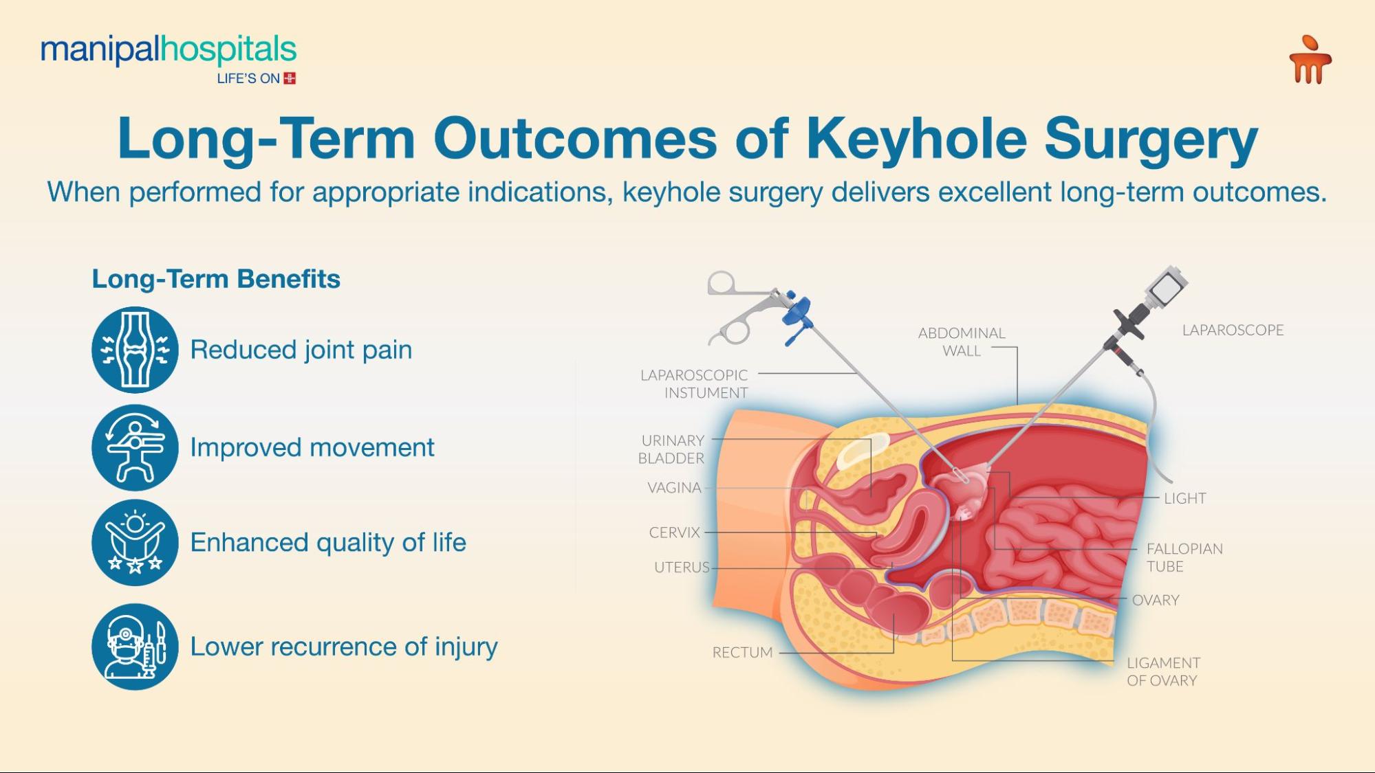 keyhole-surgery-knee-shoulder-pain-treatment-guide