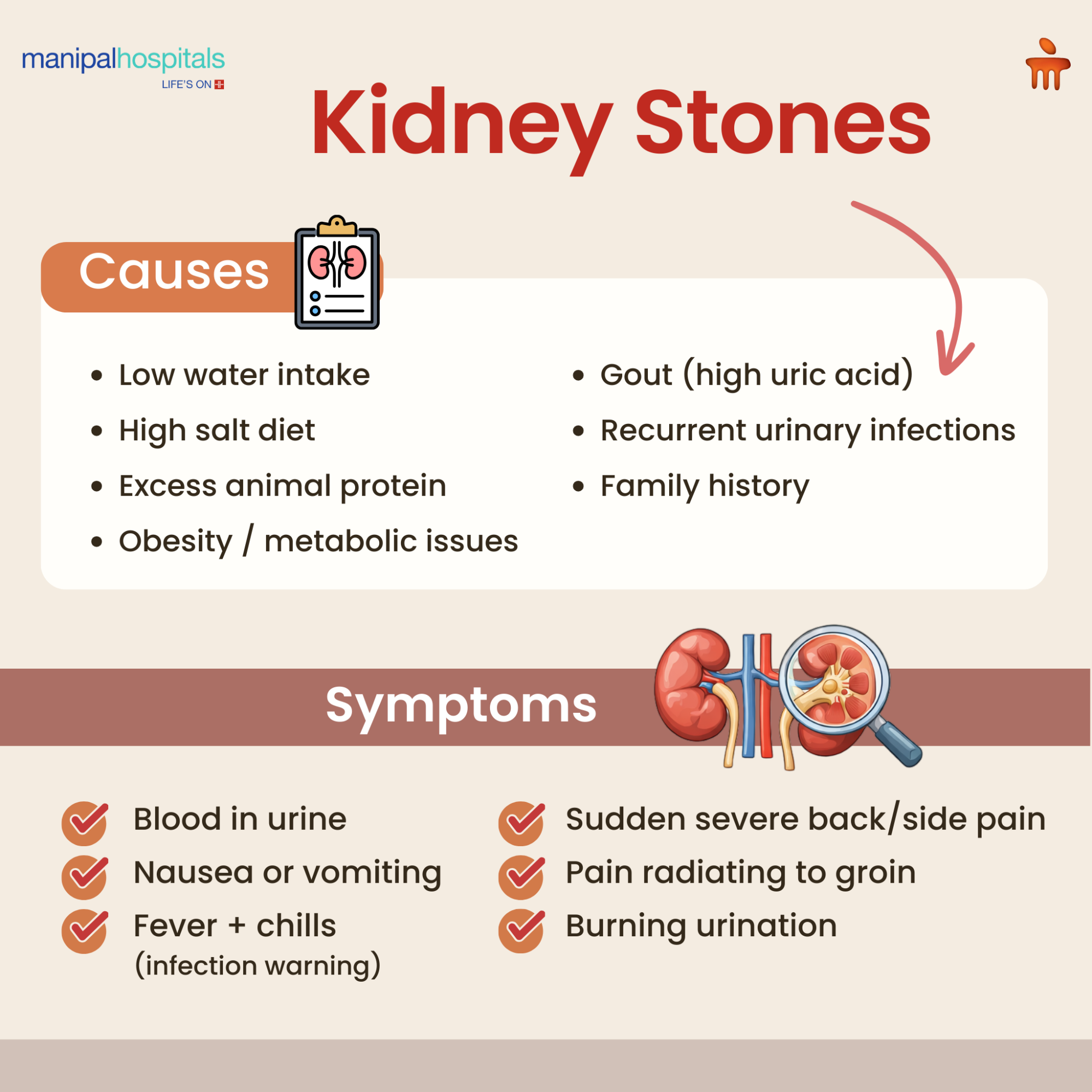 kidney-stones-causes-symptoms-treatment