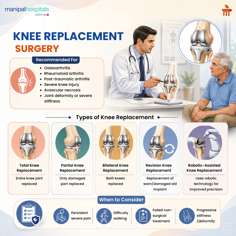 knee-replacement-surgery-what-to-expect