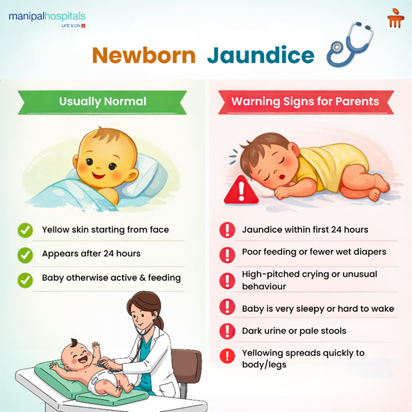 neonatal-jaundice-symptoms-and-treatment