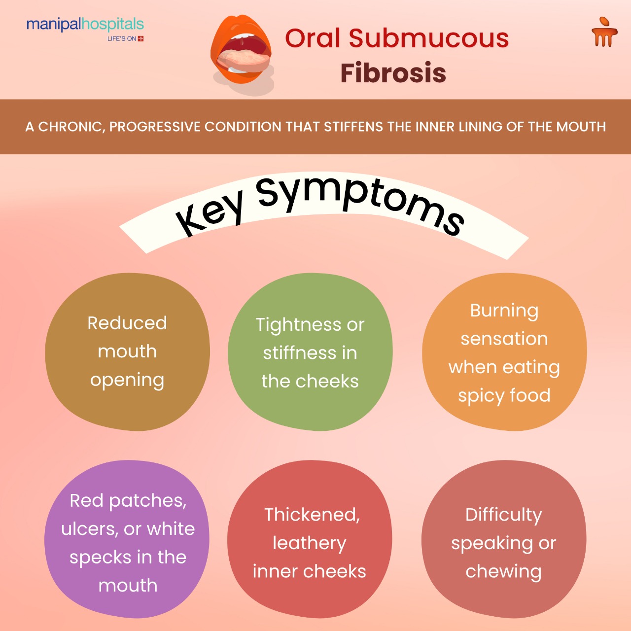Infographic on early signs of Oral Submucous Fibrosis (OSMF)