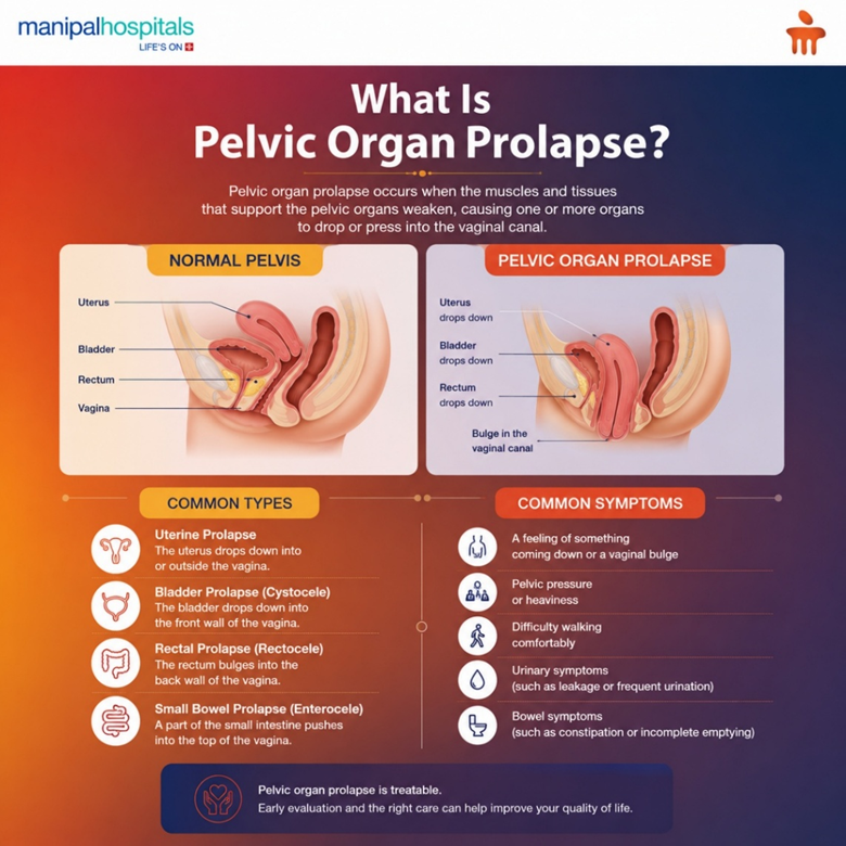 Pelvic Organ Prolapse Treatment for High-Risk Patients:A Case Study