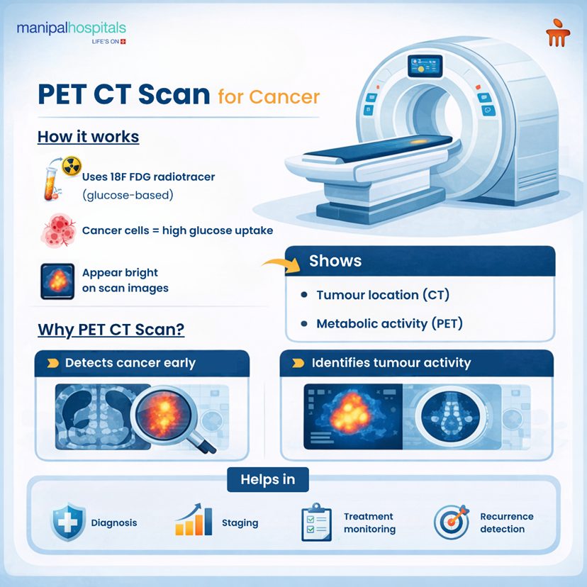 pet-ct-scan-for-cancer-detection-and-treatment