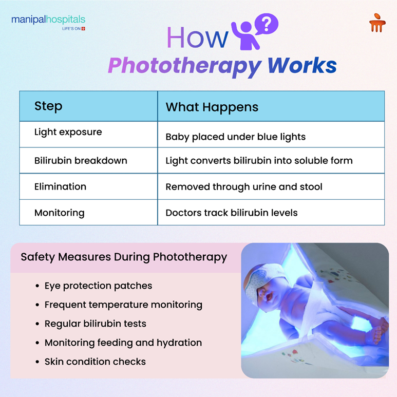 phototherapy-in-newborns-jaundice