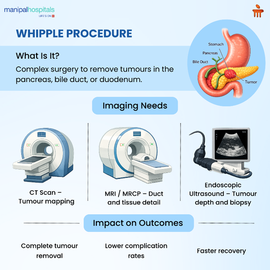 precision-imaging-surgical-planning-whipple-procedure