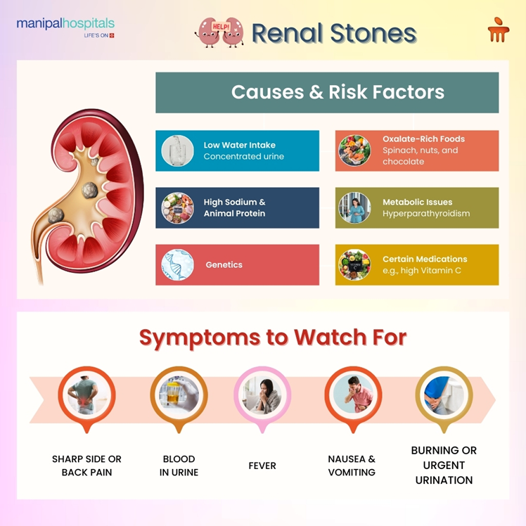 Understanding Kidney Stone Causes, Symptoms, and Treatment Options