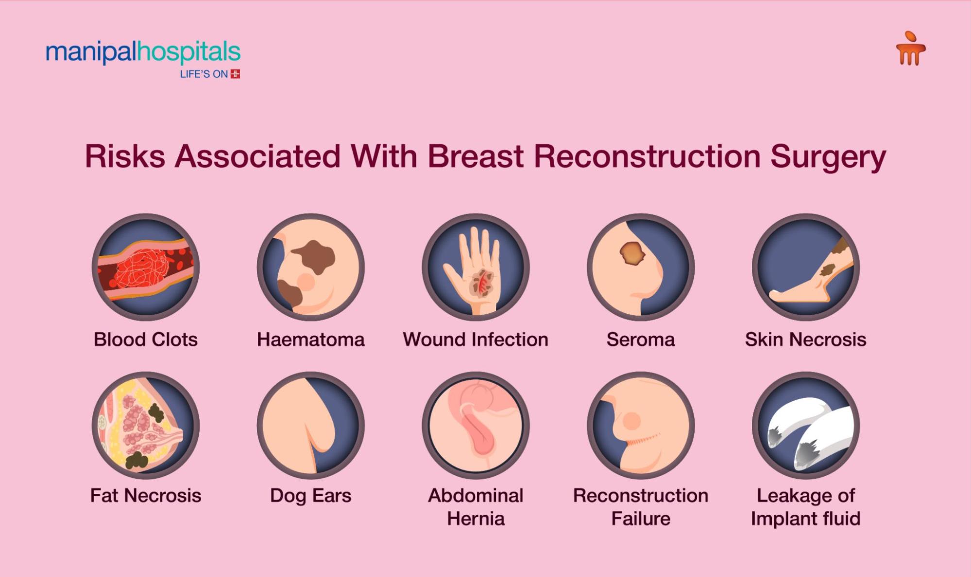 Risks associated with breast reconstruction surgery