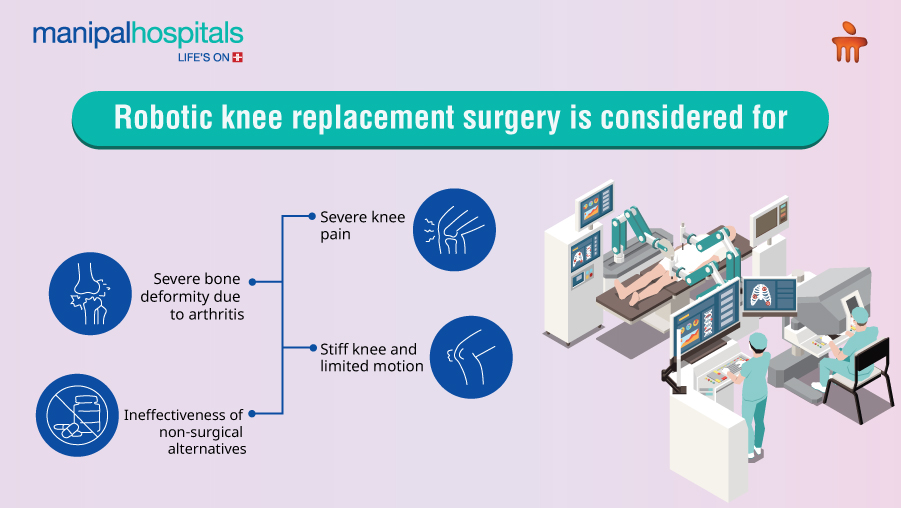 Robotic Knee Replacement: Myths & Facts Explained