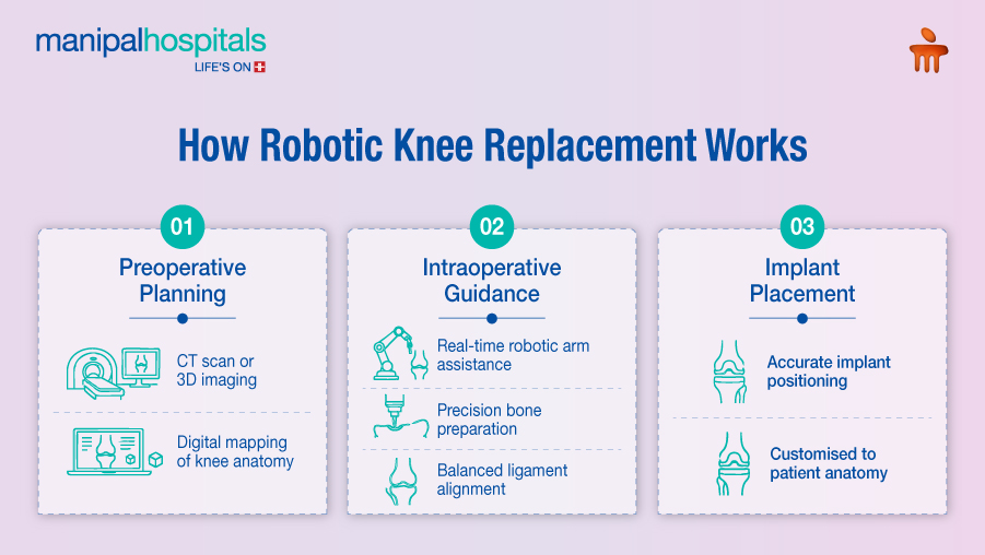 robotic knee replacement