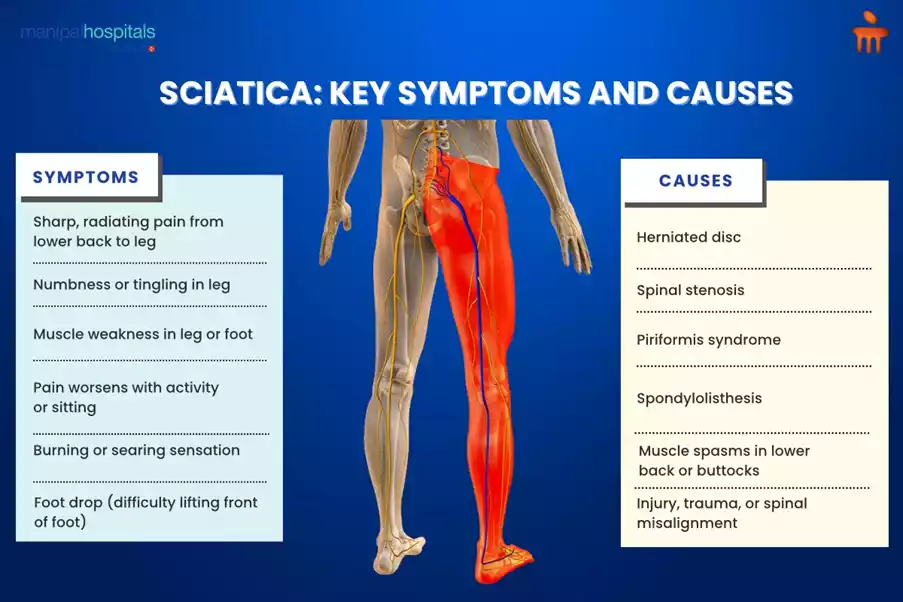 sciatica pain treatment