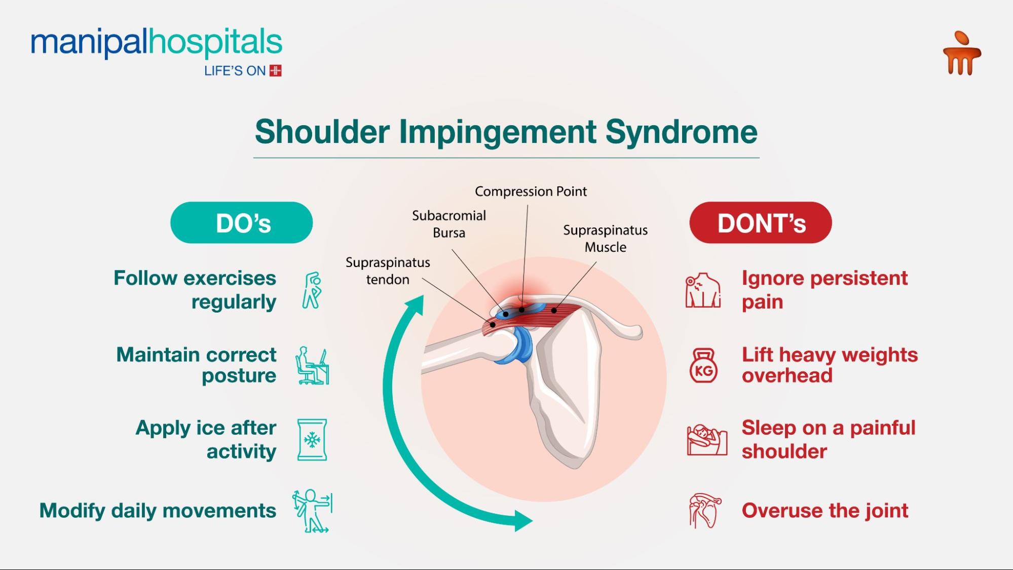 Shoulder impingement syndrome