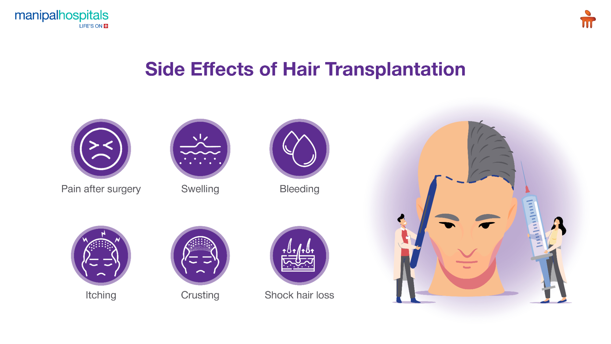 side effects of hair transplantation