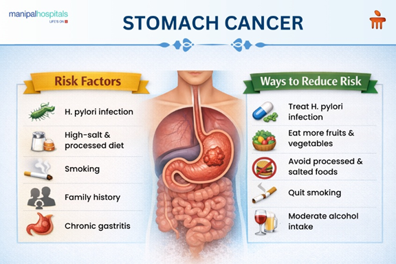 stomach-cancer-causes-and-risk-factors