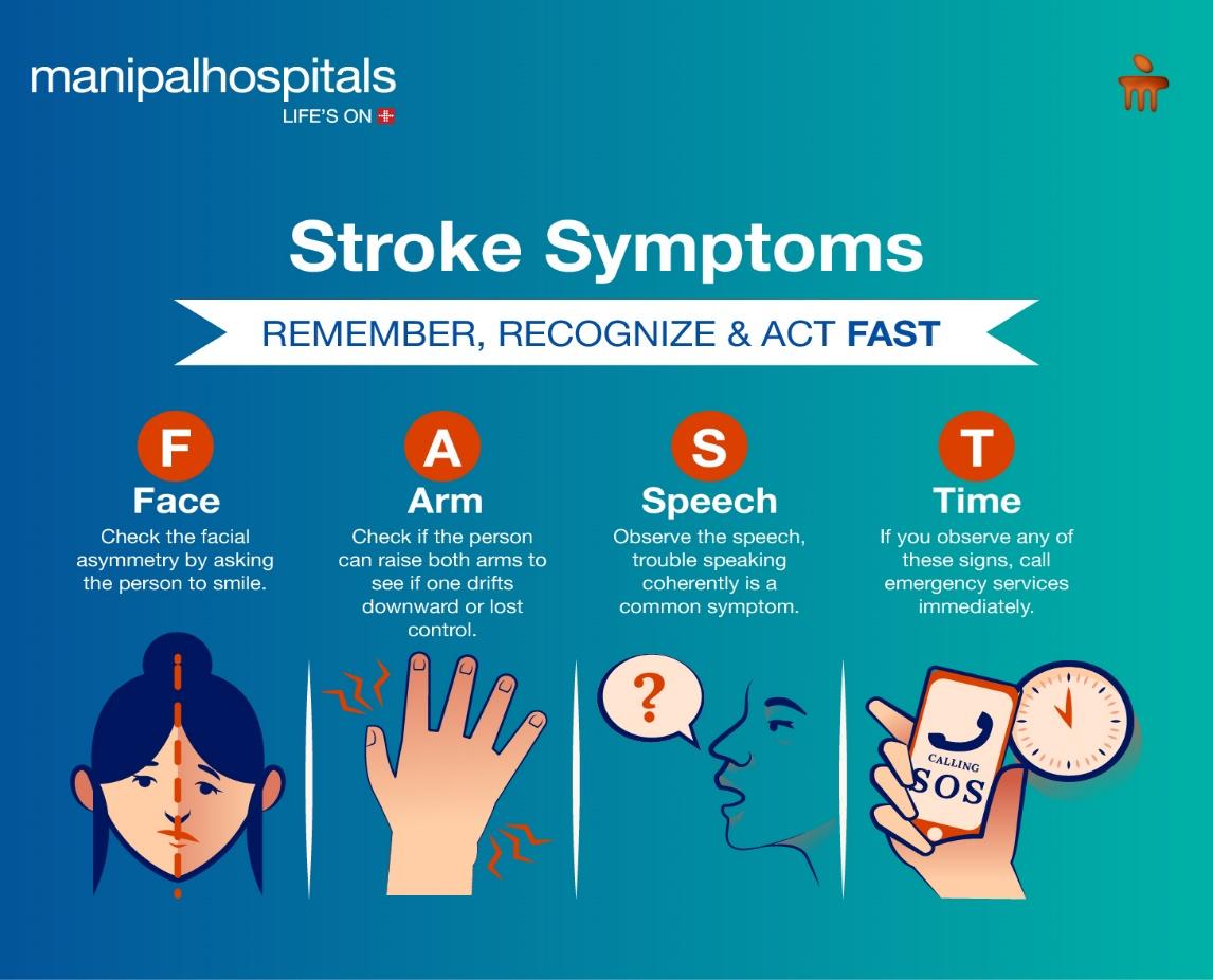 stroke symptoms face