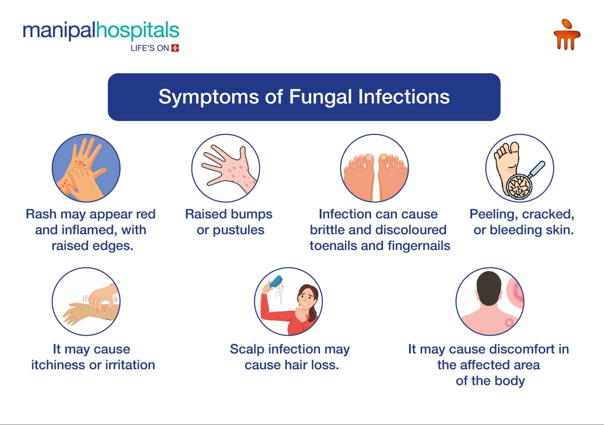 symptoms of fungal infections