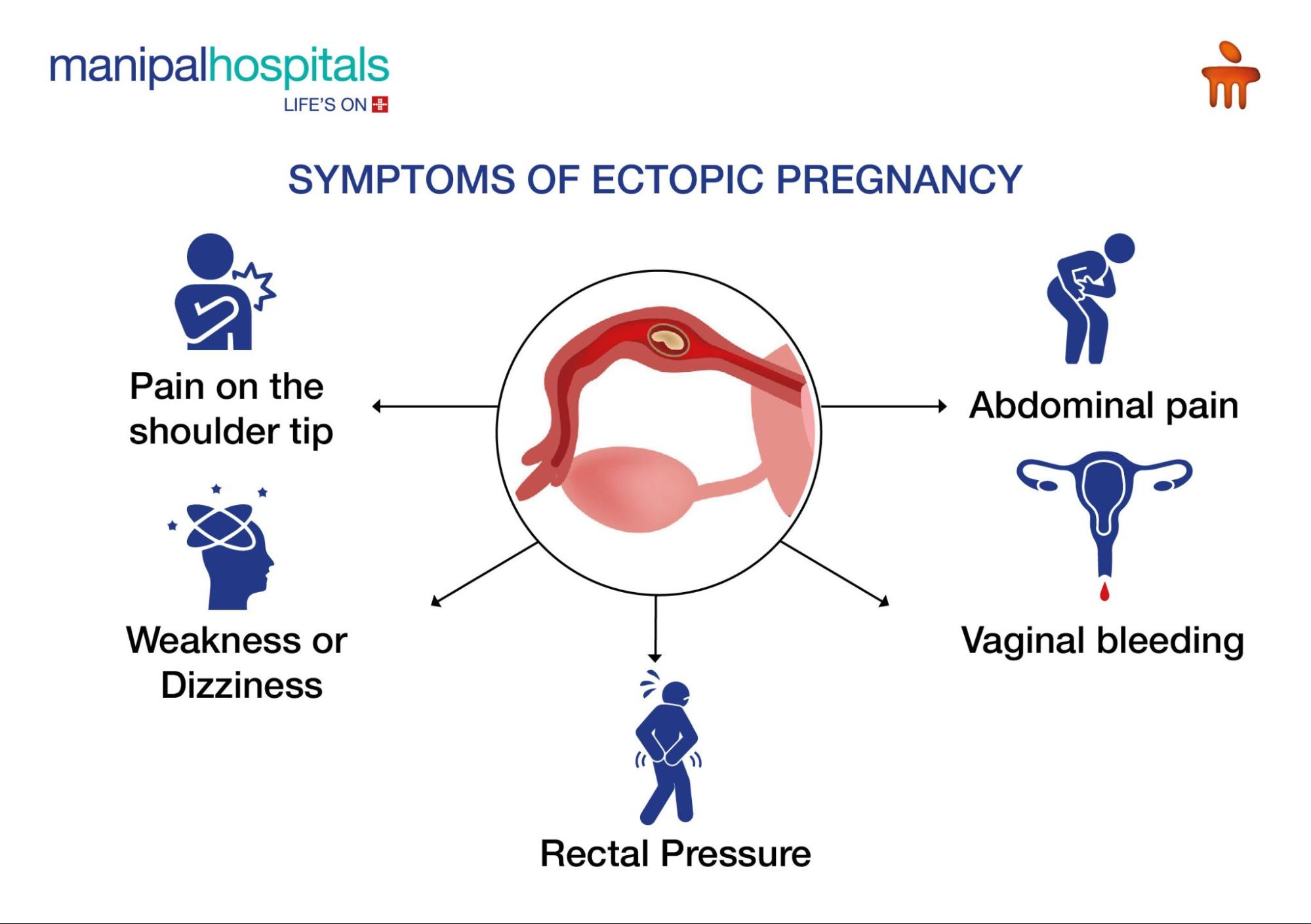 Symptoms of ectopic pregnancy