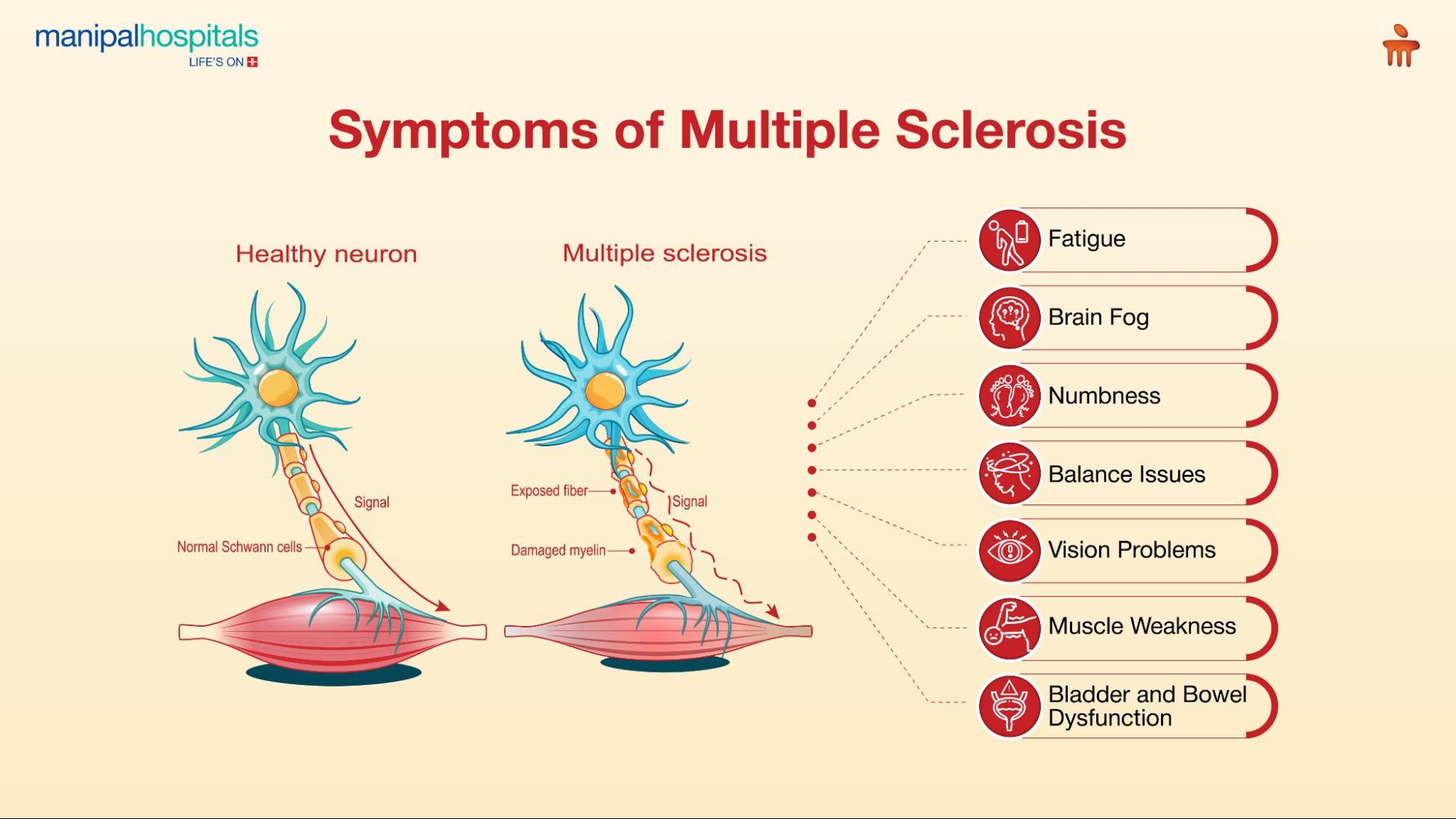 multiple-sclerosis-symptoms-causes-and-treatment