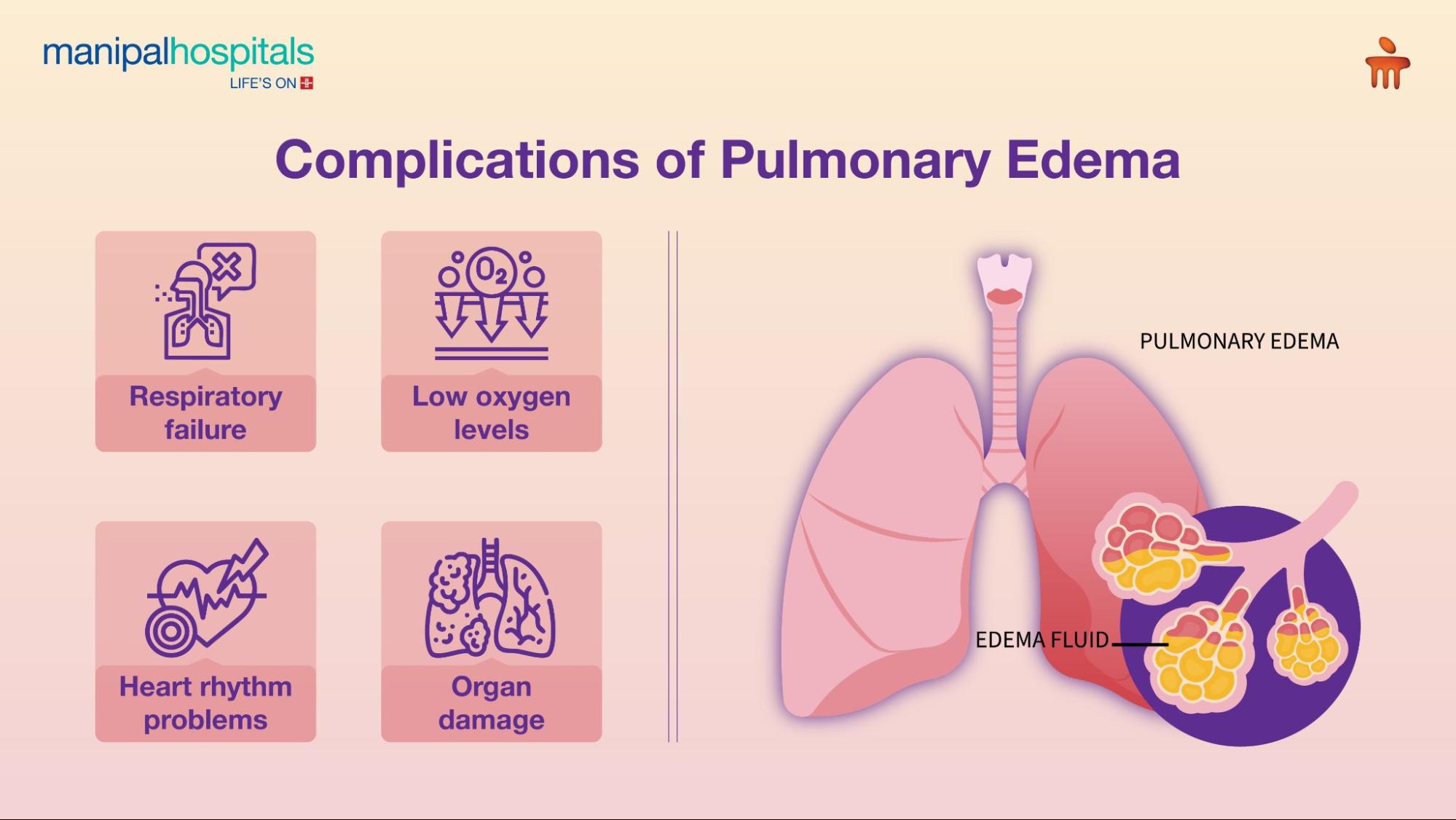 pulmonary edema causes​