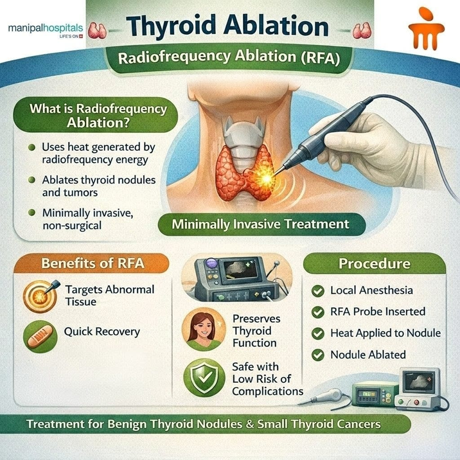 Understanding Thyroid Ablation: The Non-Surgical Thyroid Nodule Treatment