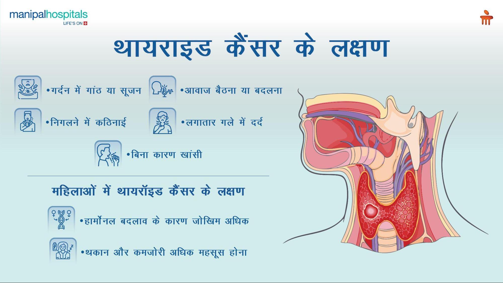 महिलाओं में थायरॉइड कैंसर के लक्षण