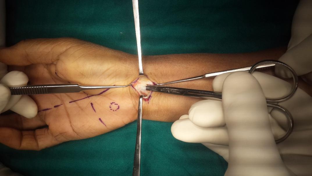 C:\Documents and Settings\mrs\My Documents\PJL\ectr pics\5.1.jpg