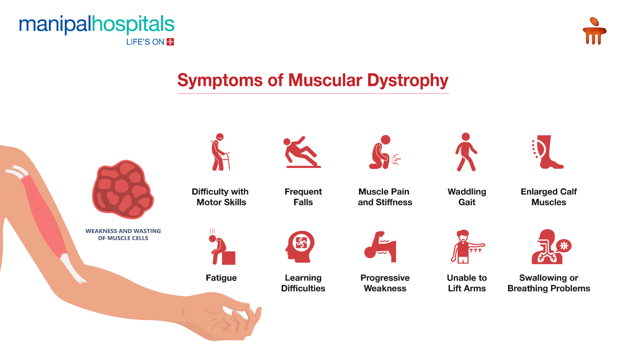 Muscle weakness warning signs