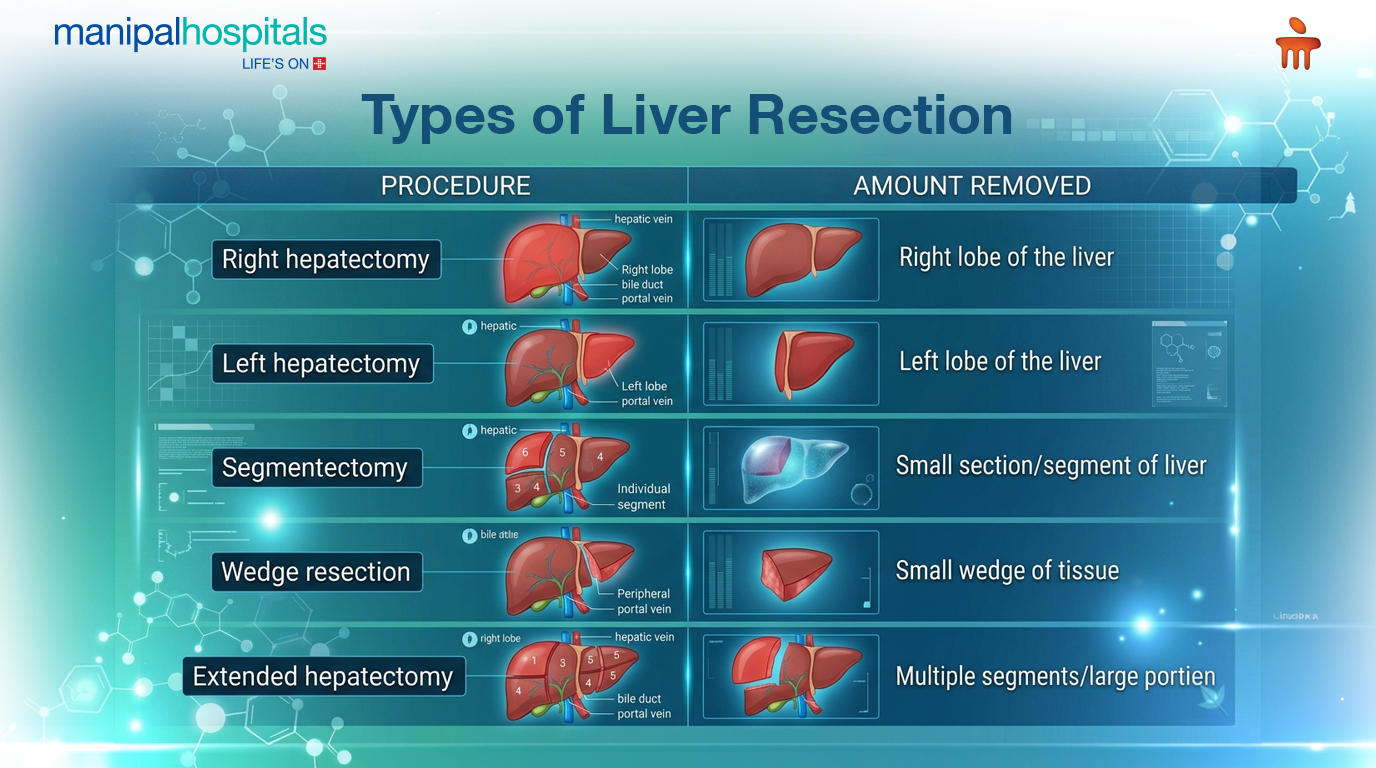 Liver Cancer Treatment