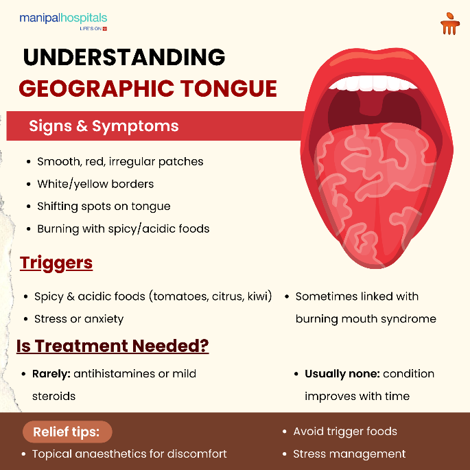 geographic-tongue-causes-symptoms-treatment