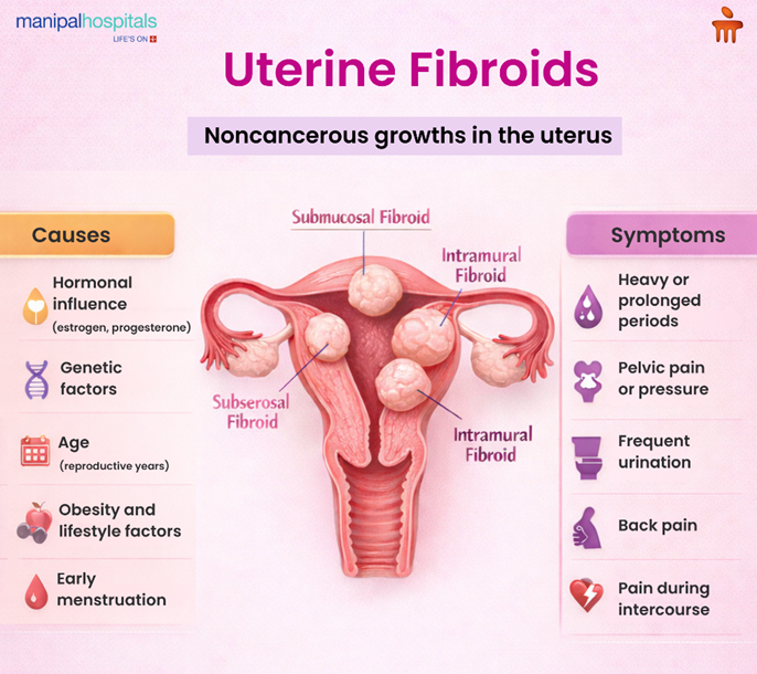 uterine-fibroids-symptoms-causes-and-treatment
