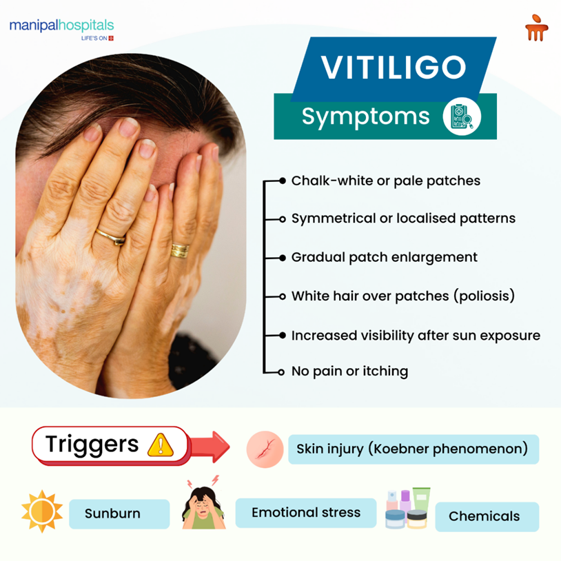 vitiligo-types-causes-treatment-options