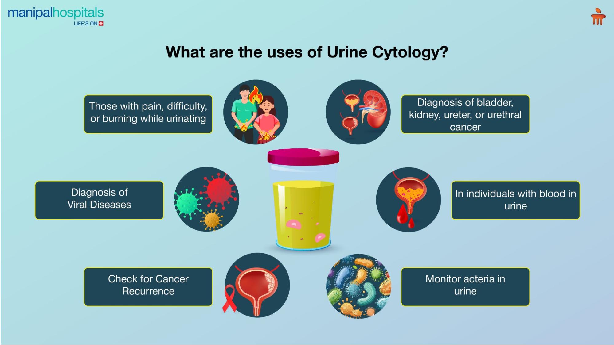 What are the uses of urine cytology