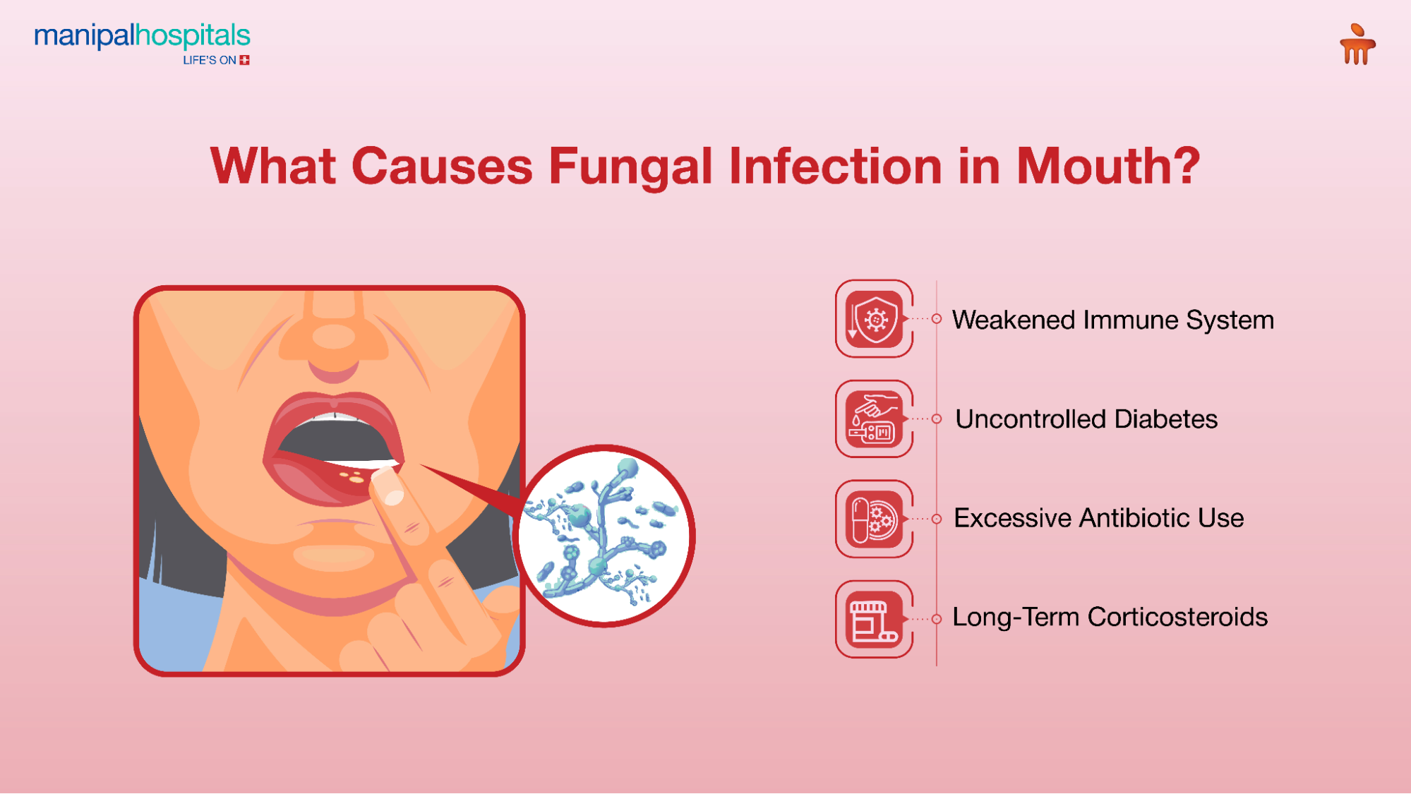 What causes fungal infection in mouth