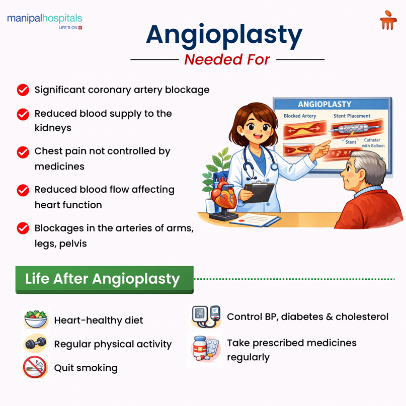 what-is-angioplasty-procedure-risks-recovery