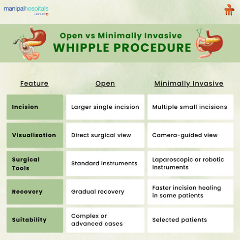 open-vs-minimally-invasive-whipple-procedure