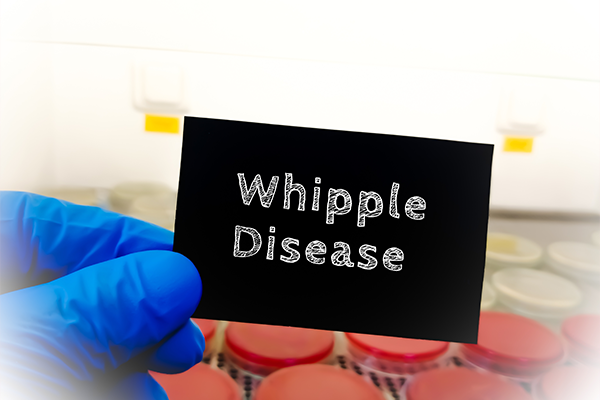 whipples-disease-rare-digestive-disorder