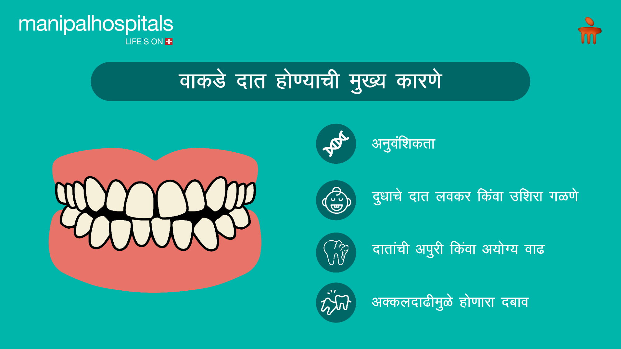 चुकीच्या पद्धतीने जुळवलेल्या दातांची गर्दी
