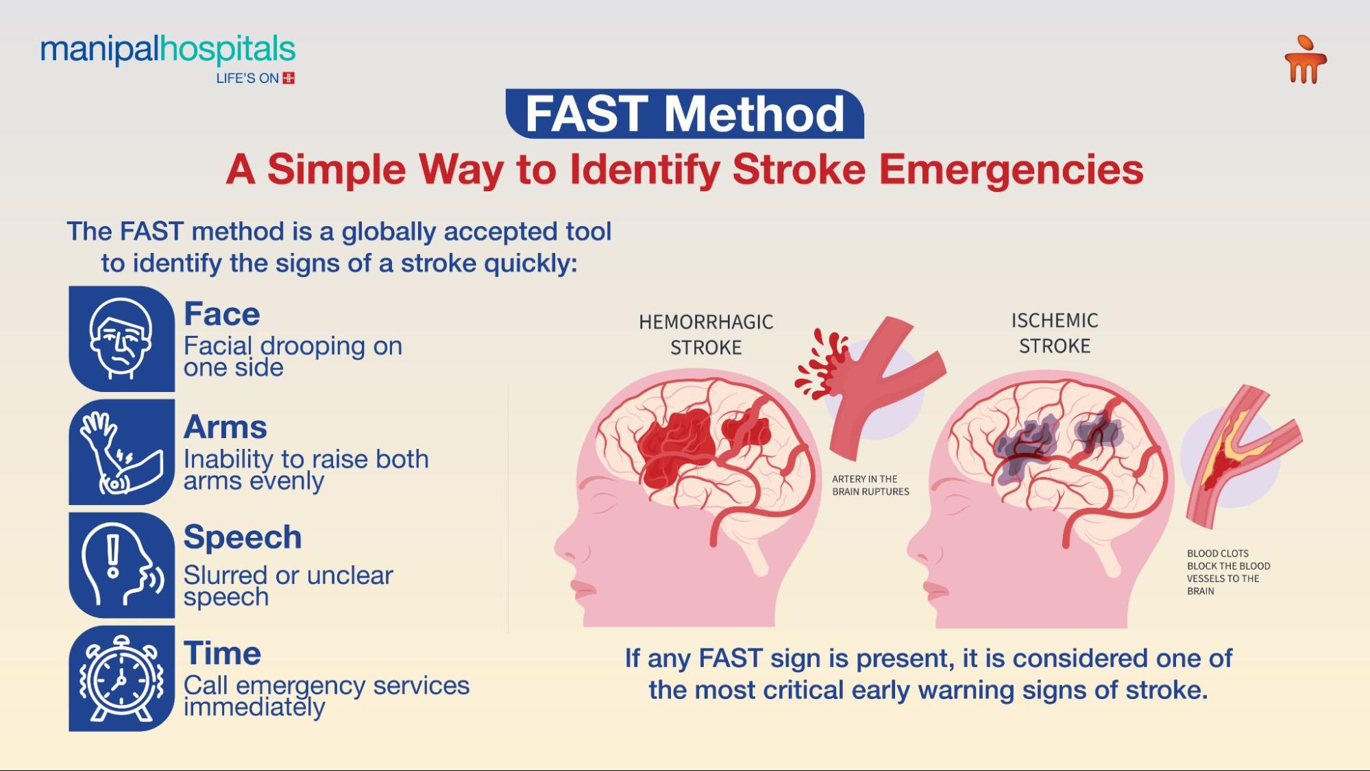 signs of a stroke