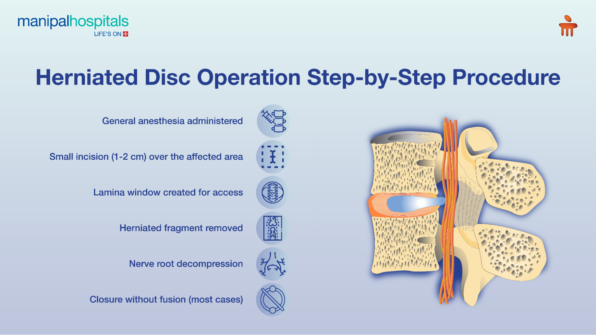 herniated disc surgery