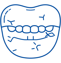 Jaw Joint Treatment in Pune | Manipal Hospitals