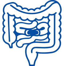 Bowel Obstruction: Symptoms & Treatment