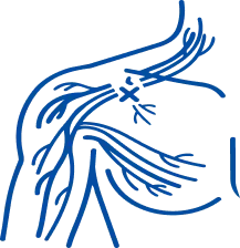 Brachial Plexus Injury: Symptoms & Treatment