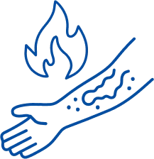 Burn Treatment in Delhi | Manipal Hospitals