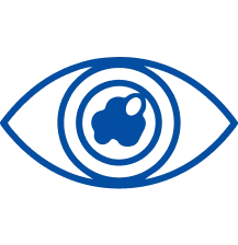 Cataract Treatment in Pune | Manipal Hospitals