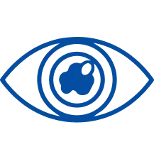 Cataract Surgery in Bangalore | Manipal Hospitals