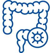 Colorectal Cancer: Symptoms, Causes & Treatment | Manipal Hospitals