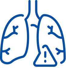 Lung Failure Treatment in Bangalore | Manipal Hospitals