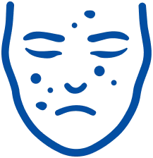 Acne Scar Treatment in Pune | Manipal Hospitals