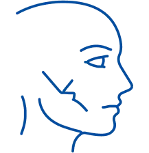 Facial Trauma: Symptoms & Treatment